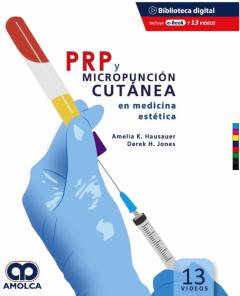 Prp Y Micropuncion Cutanea En Medicina Estetica